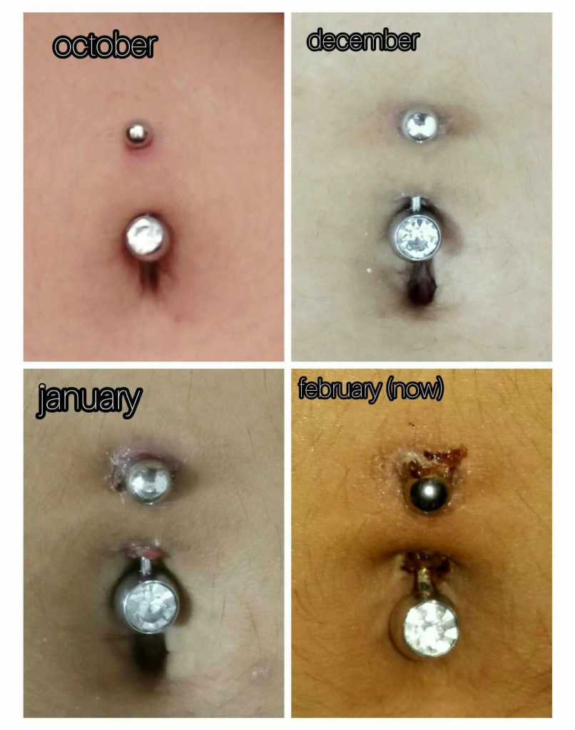 Can You Feel If a Piercing is Moving