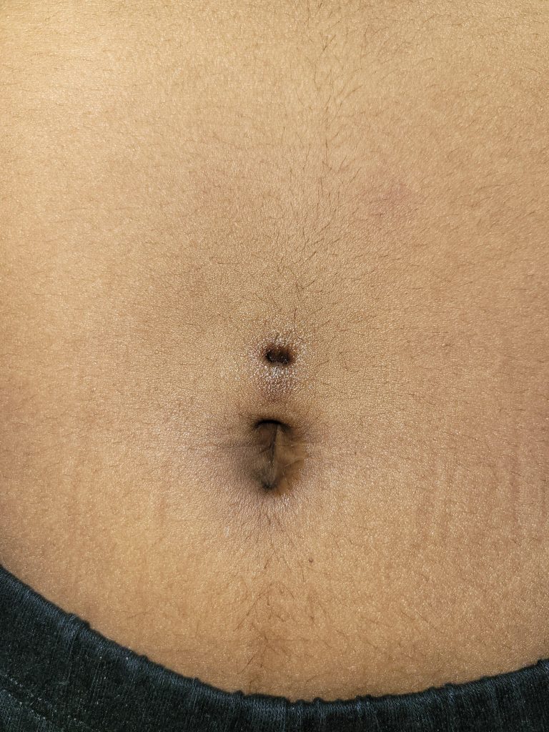 Do Belly Button Piercings Close