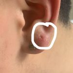 Do Ear Piercings Close