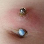 Does the Belly Button Piercing Hurt