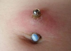 Does the Belly Button Piercing Hurt