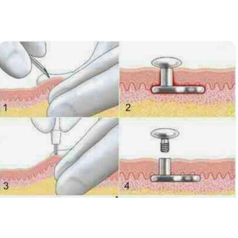How Do Dermal Piercings Work