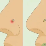 How Long Do Nostril Piercings Take to Heal