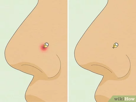 How Long Do Nostril Piercings Take to Heal