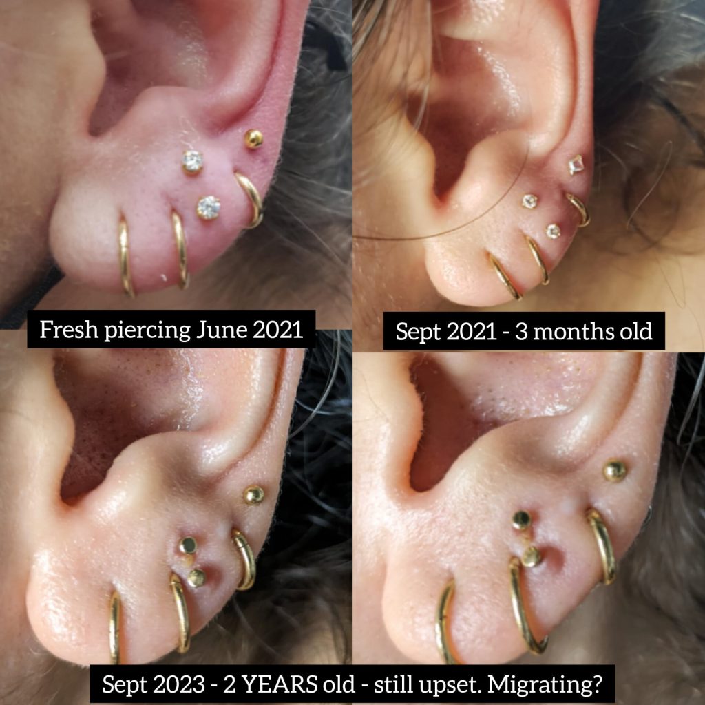 How Long Does a Lobe Piercing Take to Heal