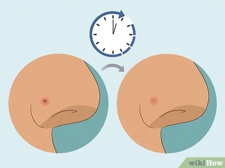 How Long Does a Nose Piercing Take to Close
