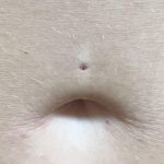 How Long Does It Take a Belly Piercing to Close