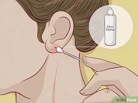 How Long Does It Take an Ear Piercing to Close