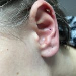 How Long for a Piercing to Fully Heal