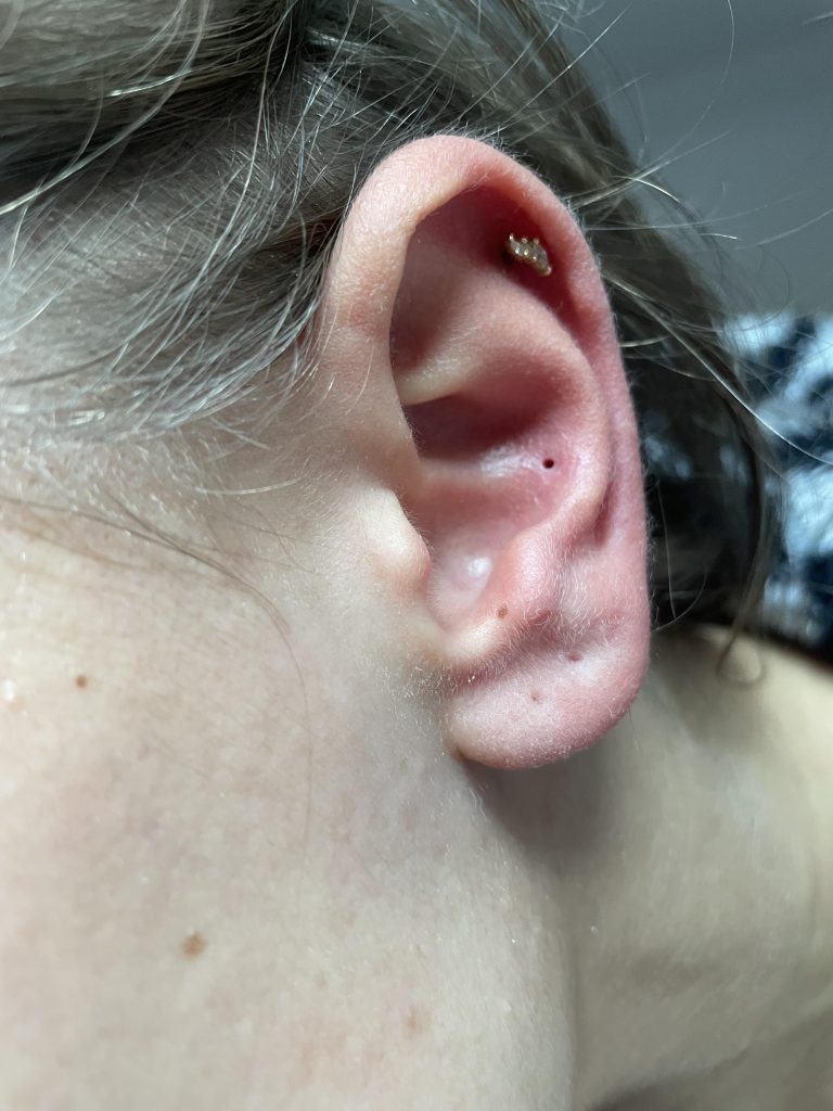 How Long for a Piercing to Fully Heal