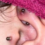 How to Calm a Piercing Bump