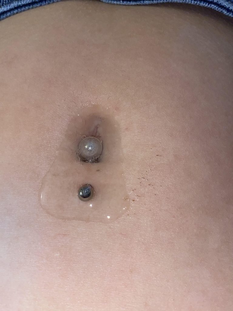 How to Clean Belly Button Piercing