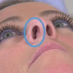 How to Fix Crooked Septum Piercing at Home Naturally