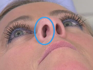 How to Fix Crooked Septum Piercing at Home Naturally