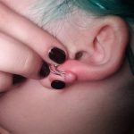 How to Get Rid of a Keloid on Piercing