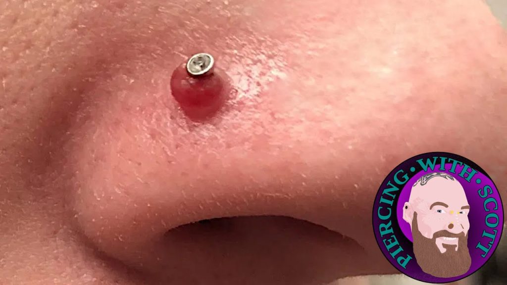How to Get Rid of a Nose Piercing Bump