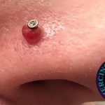 How to Get Rid of a Nose Piercing Bump