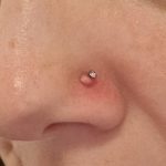 How to Get Rid of Bump on Nose Piercing