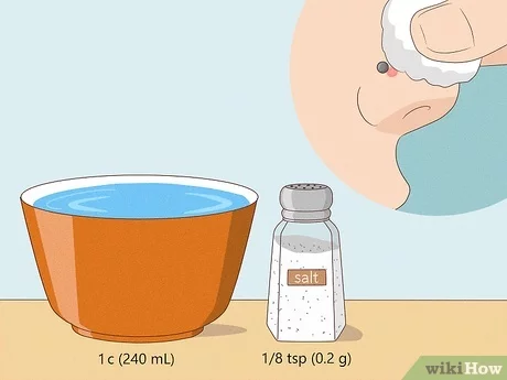 How to Get Rid of Bump on Nose Piercing Overnight