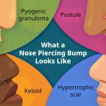 How to Get Rid of Piercing Bump