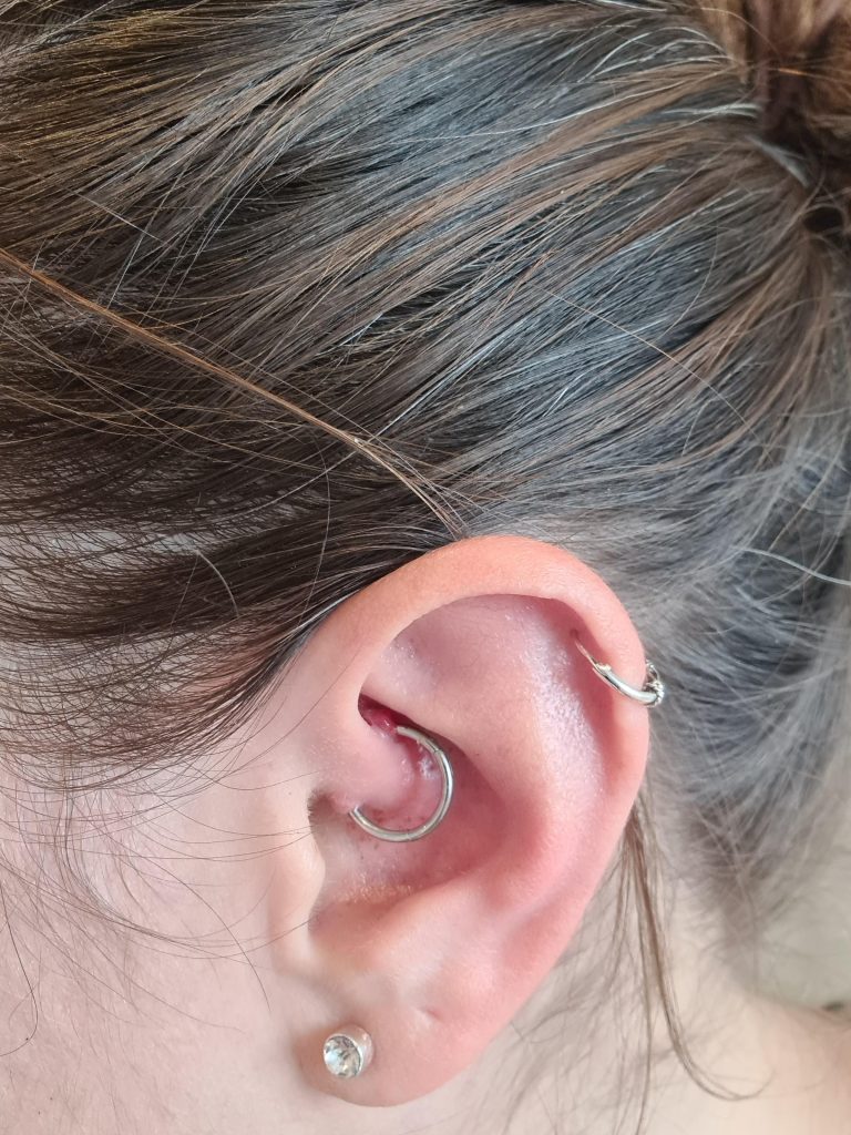 How to Heal Piercing Bump on Daith