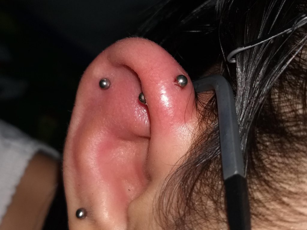 How to Make a Swollen Ear Piercing Go down
