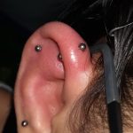 How to Make a Swollen Ear Piercing Go down