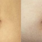 How to Remove Belly Button Piercing