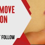 How to Remove Navel Piercing