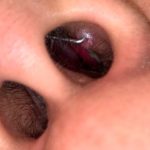 How to Tell If Your Nose Piercing is Infected