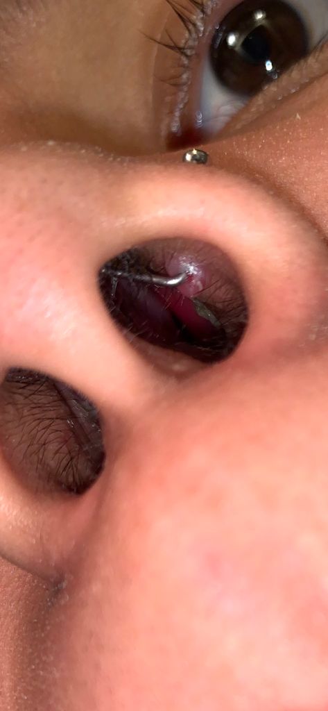 How to Tell If Your Nose Piercing is Infected
