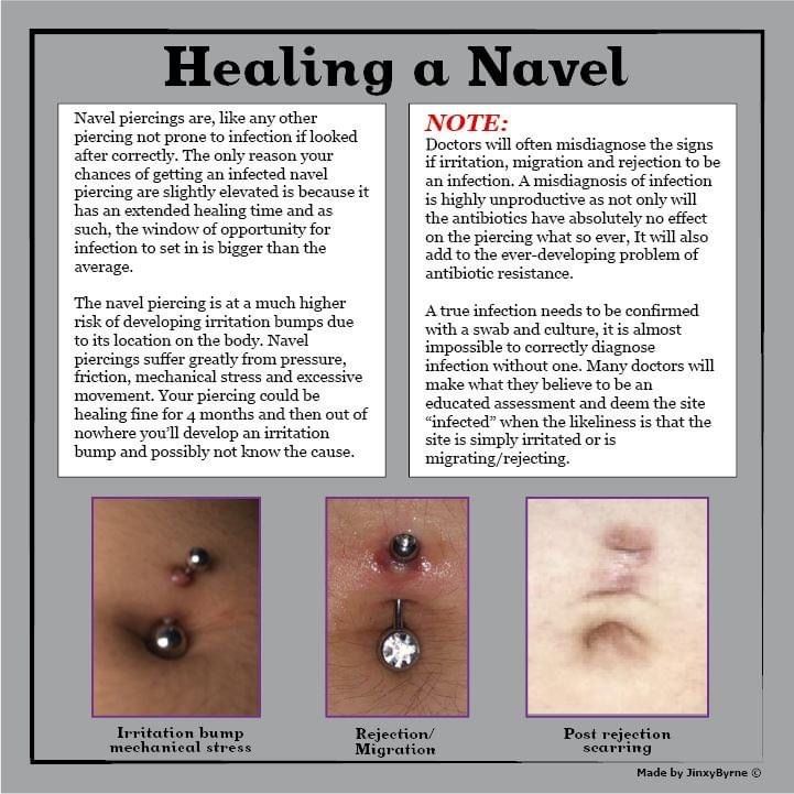 How to Treat an Infected Belly Piercing