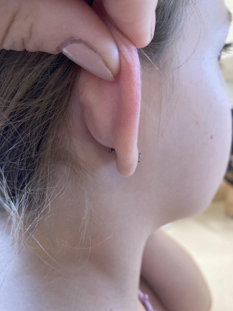What Angle to Pierce Lobes