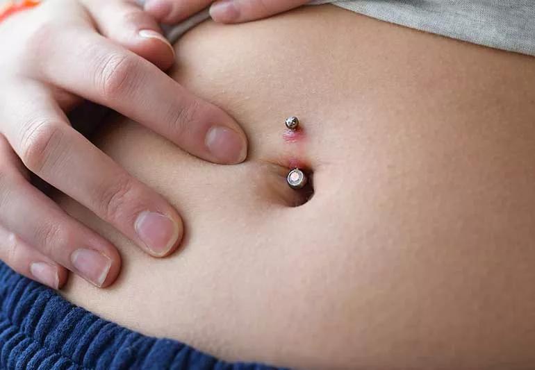 What Does an Infected Navel Piercing Look Like