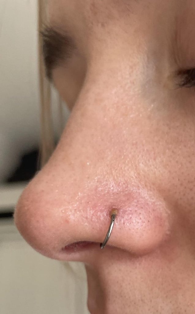 What Gauge is Nose Piercing