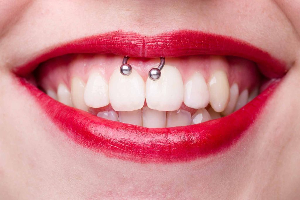 What is a Smiley Piercing