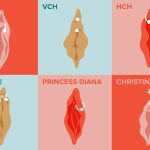 What is a Vch Piercing