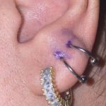 When Can I Change My Lobe Piercing to a Hoop