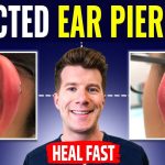 When to Go to Doctor for Ear Piercing Infection