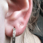 Why are My Ears Itching So Bad Months After Piercing
