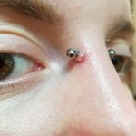 Will a Bridge Piercing Bump Go Away