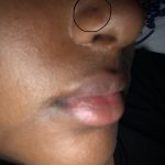 Will Nose Piercings Close