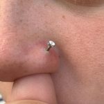 Why Is There A White Ring Around My Nose Piercing