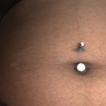 How To Get Rid Of Hyperpigmentation Around Belly Button Piercing