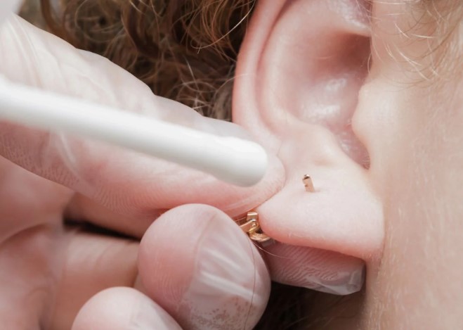 Best Numbing Cream for Ear Piercing