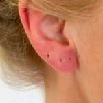 Why Does My Earring Hole Hurt After Years